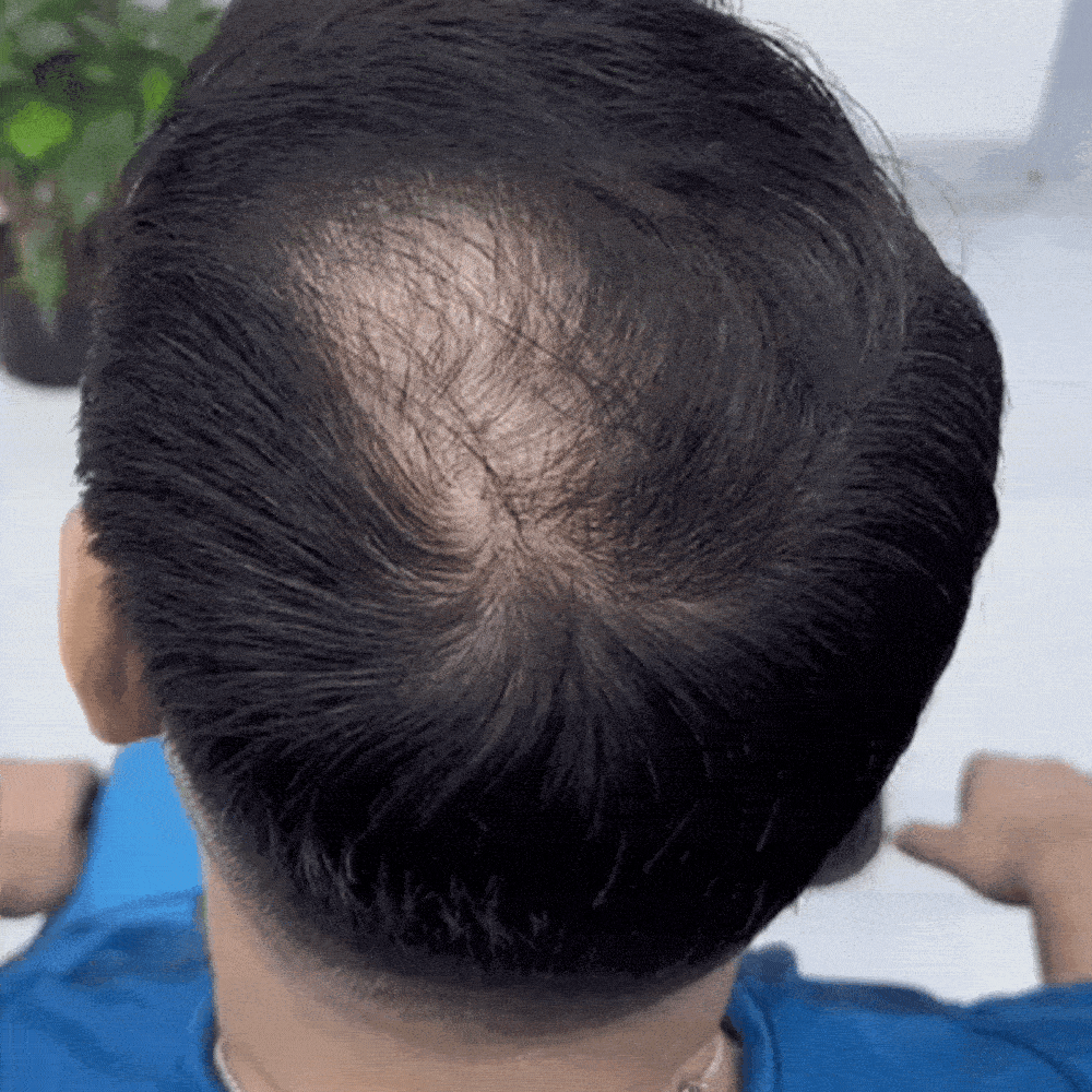 Hair Powder Pro